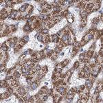 MCCC2 Antibody in Immunohistochemistry (Paraffin) (IHC (P))