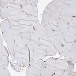 MCCC2 Antibody in Immunohistochemistry (Paraffin) (IHC (P))