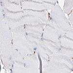 MCCC2 Antibody in Immunohistochemistry (Paraffin) (IHC (P))