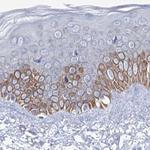 MCCC2 Antibody in Immunohistochemistry (Paraffin) (IHC (P))