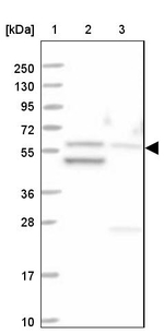 MCCC2 Antibody in Western Blot (WB)