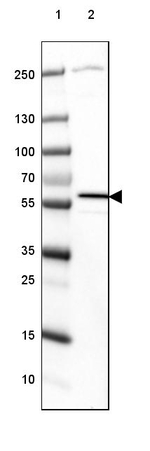 MCCC2 Antibody in Western Blot (WB)