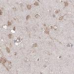 eIF3a Antibody in Immunohistochemistry (Paraffin) (IHC (P))