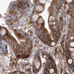 eIF3a Antibody in Immunohistochemistry (Paraffin) (IHC (P))