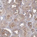 eIF3a Antibody in Immunohistochemistry (Paraffin) (IHC (P))