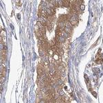 eIF3a Antibody in Immunohistochemistry (Paraffin) (IHC (P))