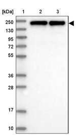 eIF3a Antibody in Western Blot (WB)