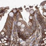 eIF3a Antibody in Immunohistochemistry (Paraffin) (IHC (P))