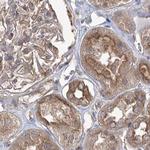 eIF3a Antibody in Immunohistochemistry (Paraffin) (IHC (P))