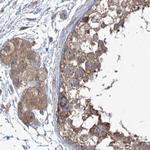 eIF3a Antibody in Immunohistochemistry (Paraffin) (IHC (P))