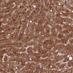 PCBP2 Antibody in Immunohistochemistry (Paraffin) (IHC (P))