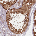 PCBP2 Antibody in Immunohistochemistry (Paraffin) (IHC (P))