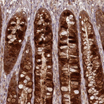 PCBP2 Antibody in Immunohistochemistry (Paraffin) (IHC (P))