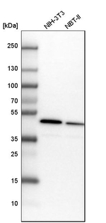 Adenosine Kinase Antibody in Western Blot (WB)