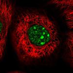 WDR74 Polyclonal Antibody