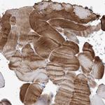 WDR74 Antibody in Immunohistochemistry (Paraffin) (IHC (P))