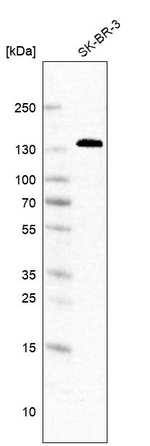 Ankyrin G Antibody in Western Blot (WB)