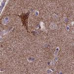 Citrate Synthase Antibody in Immunohistochemistry (Paraffin) (IHC (P))