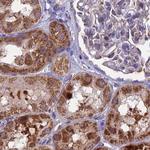 Citrate Synthase Antibody in Immunohistochemistry (Paraffin) (IHC (P))