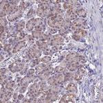 Citrate Synthase Antibody in Immunohistochemistry (Paraffin) (IHC (P))