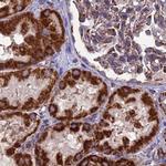 Citrate Synthase Antibody in Immunohistochemistry (Paraffin) (IHC (P))