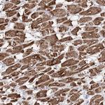 PDHX Antibody in Immunohistochemistry (Paraffin) (IHC (P))
