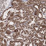 PDHX Antibody in Immunohistochemistry (Paraffin) (IHC (P))
