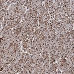 PDHX Antibody in Immunohistochemistry (Paraffin) (IHC (P))
