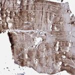 PDHX Antibody in Immunohistochemistry (Paraffin) (IHC (P))