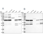 PDHX Antibody in Western Blot (WB)