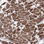 PDHX Antibody in Immunohistochemistry (Paraffin) (IHC (P))