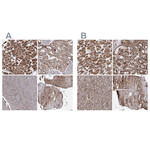 PDHX Polyclonal Antibody