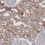 PDHX Antibody in Immunohistochemistry (Paraffin) (IHC (P))