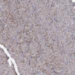 PDHX Antibody in Immunohistochemistry (Paraffin) (IHC (P))