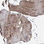 PDHX Antibody in Immunohistochemistry (Paraffin) (IHC (P))