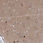Syntaxin 6 Antibody in Immunohistochemistry (Paraffin) (IHC (P))