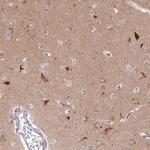 Syntaxin 6 Antibody in Immunohistochemistry (Paraffin) (IHC (P))