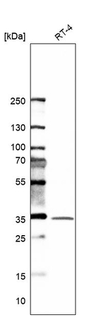 Syntaxin 6 Antibody in Western Blot (WB)