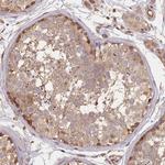 MADD Antibody in Immunohistochemistry (Paraffin) (IHC (P))