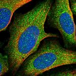 TOLLIP Polyclonal Antibody