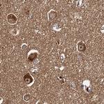 TOLLIP Antibody in Immunohistochemistry (Paraffin) (IHC (P))