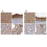 TOLLIP Antibody in Immunohistochemistry (Paraffin) (IHC (P))