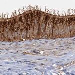 TOLLIP Antibody in Immunohistochemistry (Paraffin) (IHC (P))