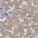 TOLLIP Antibody in Immunohistochemistry (Paraffin) (IHC (P))