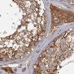TOLLIP Antibody in Immunohistochemistry (Paraffin) (IHC (P))