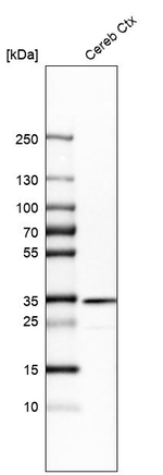 TOLLIP Antibody in Western Blot (WB)