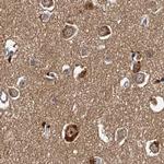 TOLLIP Antibody in Immunohistochemistry (Paraffin) (IHC (P))