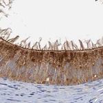 TOLLIP Antibody in Immunohistochemistry (Paraffin) (IHC (P))