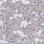 TOLLIP Antibody in Immunohistochemistry (Paraffin) (IHC (P))