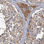 TOLLIP Antibody in Immunohistochemistry (Paraffin) (IHC (P))